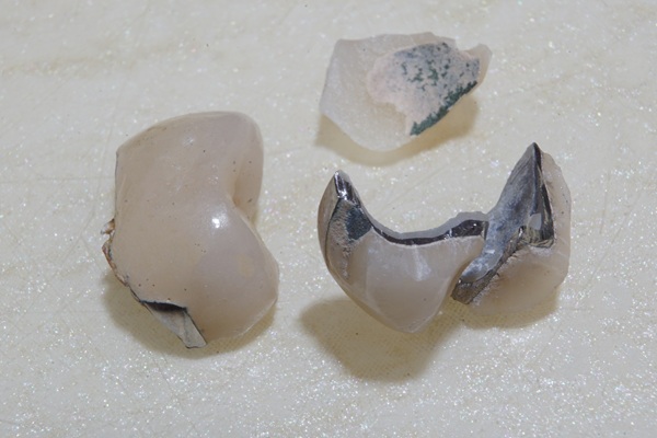 Getting A Broken  Dental Crown Repaired Or Replaced